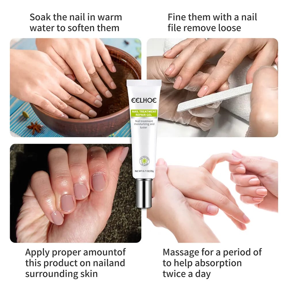 Nail Treatment Repair Gel 20g - Toe Health Foot Care Gel Nail Treatment Repair Gel 20g - Toe Health Foot Care Gel