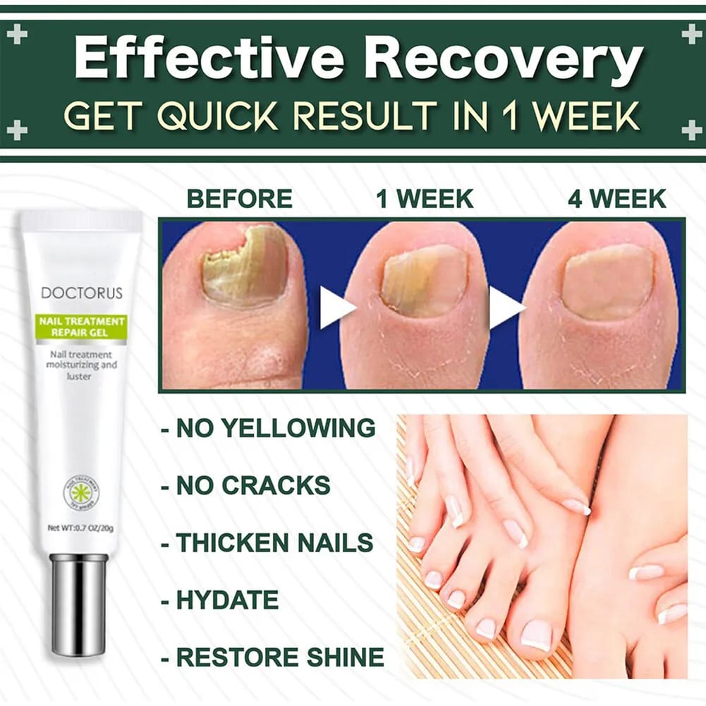 Nail Treatment Repair Gel 20g - Toe Health Foot Care Gel Nail Treatment Repair Gel 20g - Toe Health Foot Care Gel