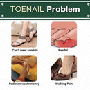 Nail Treatment Repair Gel 20g - Toe Health Foot Care Gel - Tuzzut.com Qatar Online Shopping