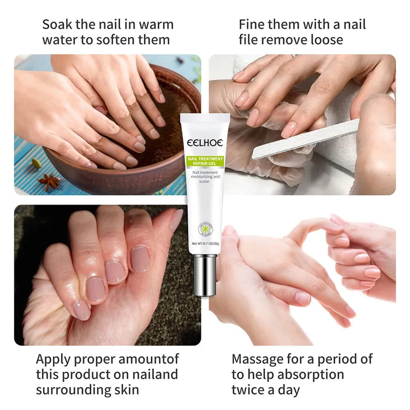 Nail Treatment Repair Gel 20g - Toe Health Foot Care Gel - Tuzzut.com Qatar Online Shopping