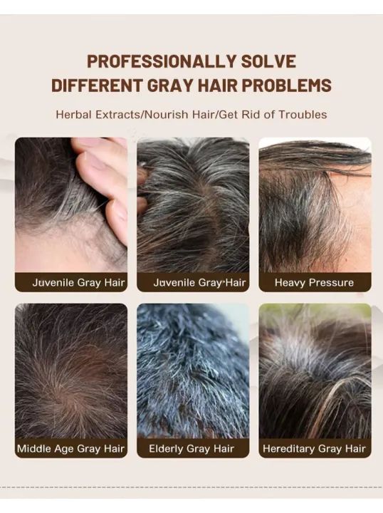 RHIXE Ganoderma Atrum Polygonum multiflorum White to Black Serum Nourish hair roots Hair Care 100ml RHIXE Ganoderma Atrum Polygonum multiflorum White to Black Serum Nourish hair roots Hair Care 100ml