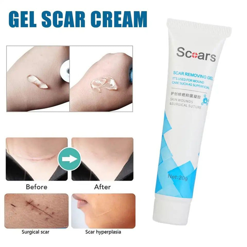 Scar Removal Gel Scar Removal Creams for Skin Barrier Repair Scar Cream for Scar Removal Body New Skin and Old Scars