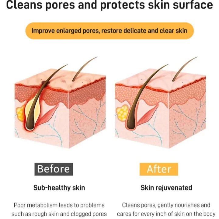 Sulfur Liquid Soap Mites Removal Bath Gel Deep Cleaning Shower Gel 300ml Sulfur Liquid Soap Mites Removal Bath Gel Deep Cleaning Shower Gel 300ml