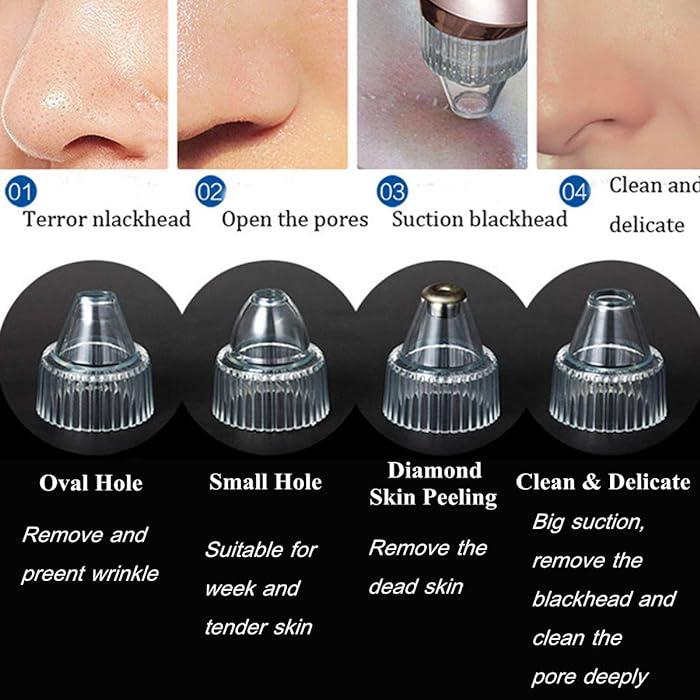 Blackhead Remover Acne Pimple Pore Vacuum Cleaner XN-8030 - Tuzzut.com Qatar Online Shopping