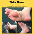 Aichun Beauty 40g Natural Foot Peel Mask Sheet - TUZZUT Qatar Online Shopping