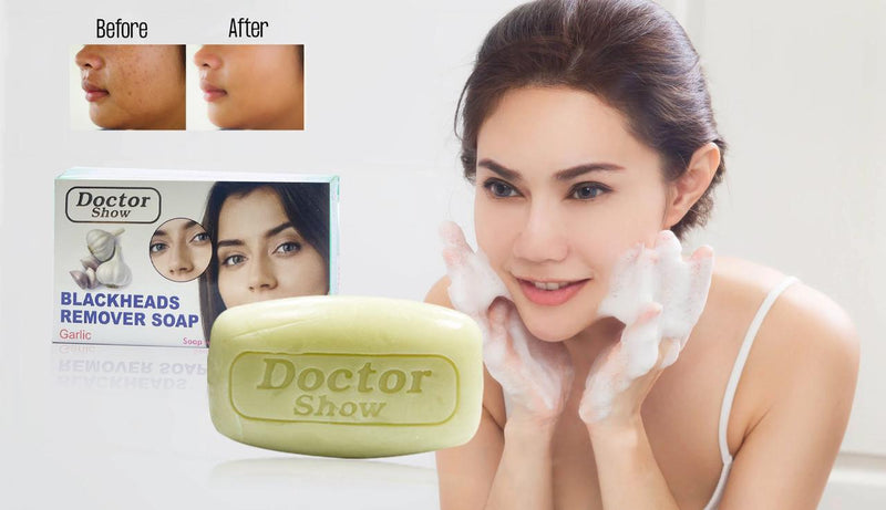 Doctor Show Blackheads Remover Soap 90g