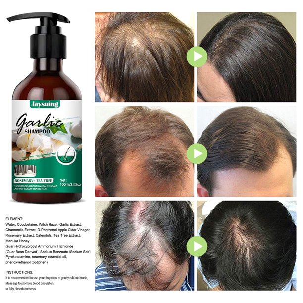 Garlic Shampoo Deep Cleansing Effective Hair Loss Treatment Garlic Shampoo Deep Cleansing Effective Hair Loss Treatment
