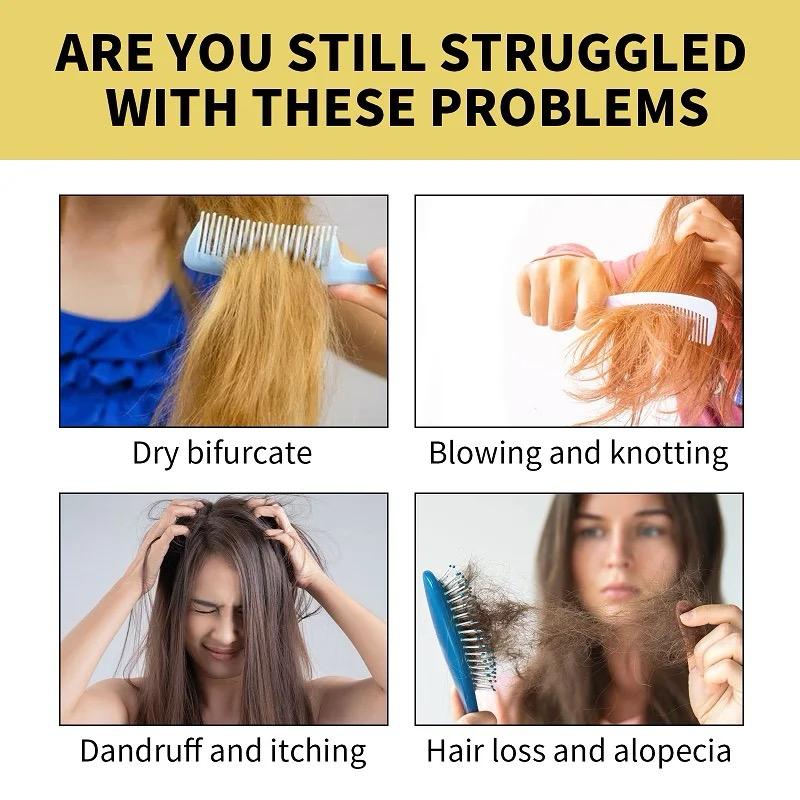 100Ml Ginger Shampoo Anti-Hair Loss Baldness and Dandruff - Tuzzut.com Qatar Online Shopping