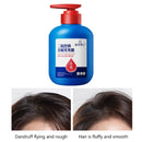 Anti-Dandruff Selenium Disulfide Shampoo - 300ml - TUZZUT Qatar Online Shopping