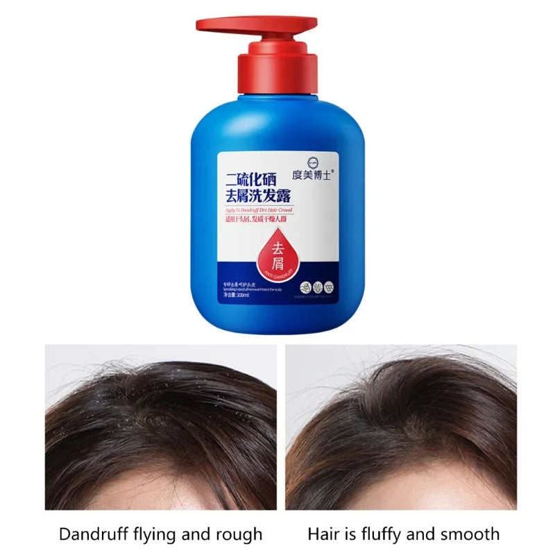 Anti-Dandruff Selenium Disulfide Shampoo - 300ml