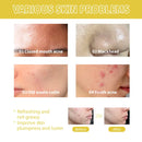 2 Pcs YARAYCIN Time Condensing Orchid Essential Oil 30ml - Moisturizing, Whitening, Soothing, Anti-Acne, Anti-Aging - TUZZUT Qatar Online Shopping