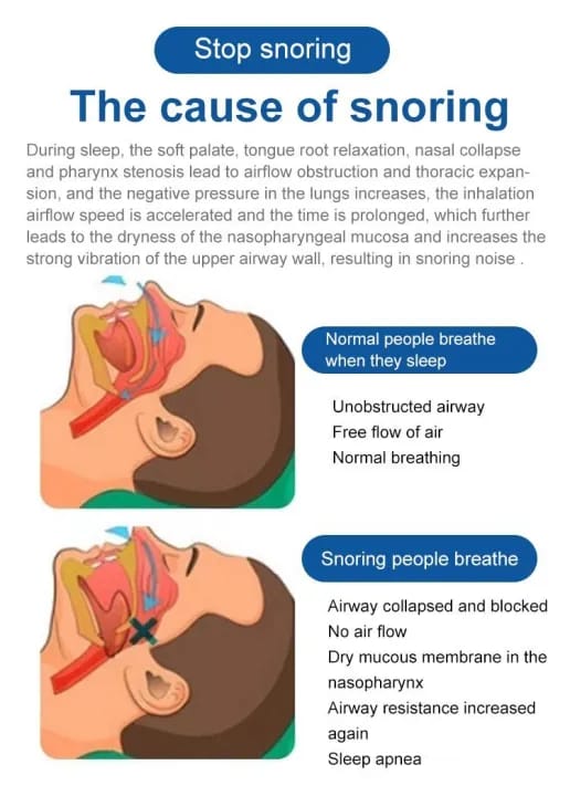 GiiMall Hengnuo anti-snoring oral spray GiiMall Hengnuo anti-snoring oral spray