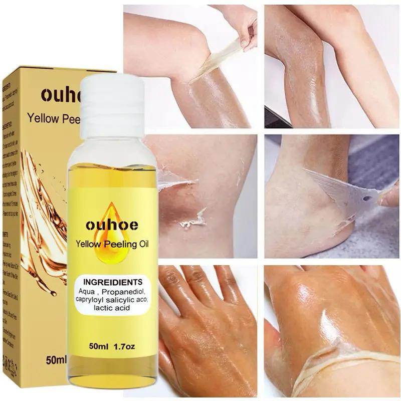 Yellow Peeling Oil Dark Skin Bleaching Remove Arm Knee Legs -50ml - Tuzzut.com Qatar Online Shopping