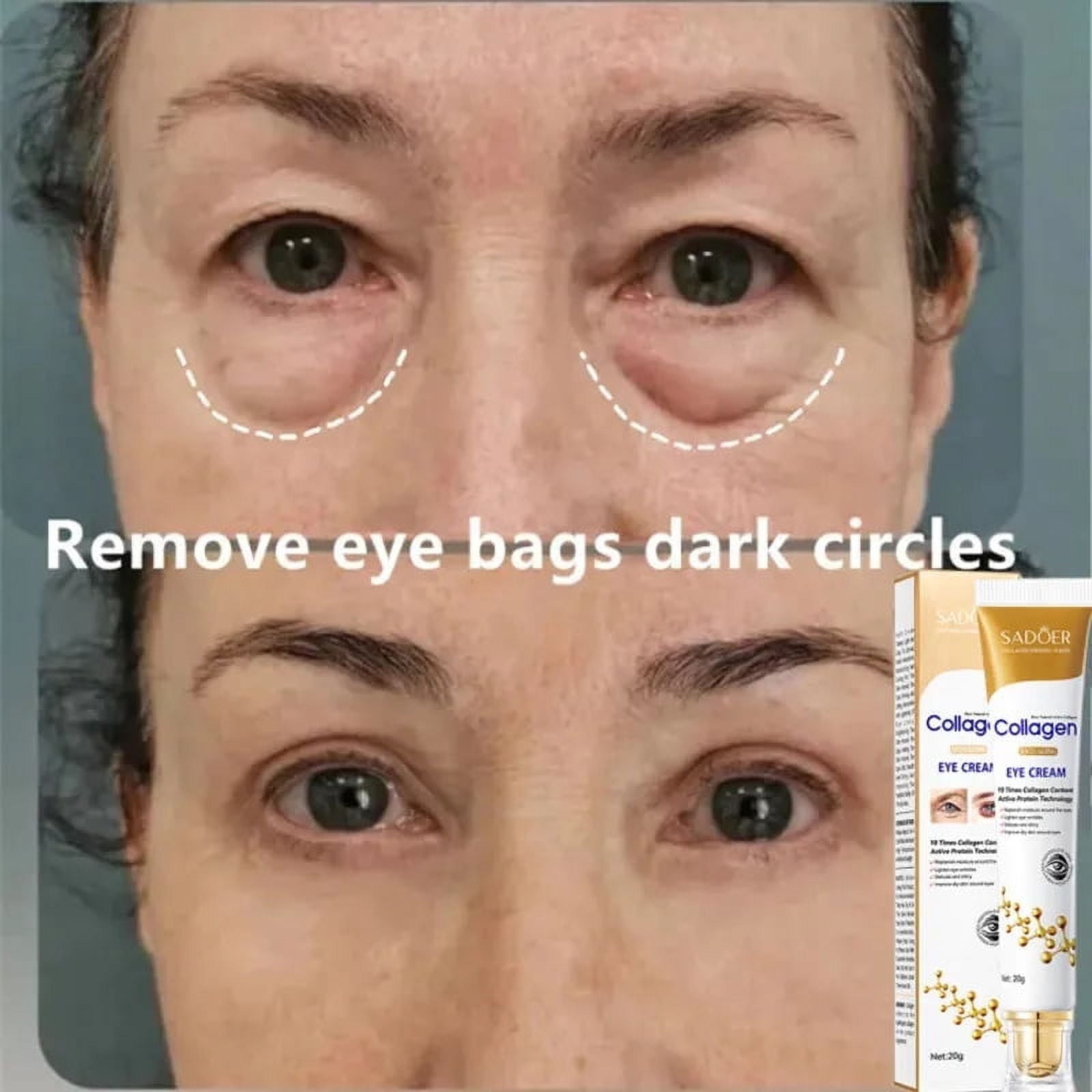 SADOER Collagen Instant Eye Bag Removal Cream 20g SADOER Collagen Instant Eye Bag Removal Cream 20g