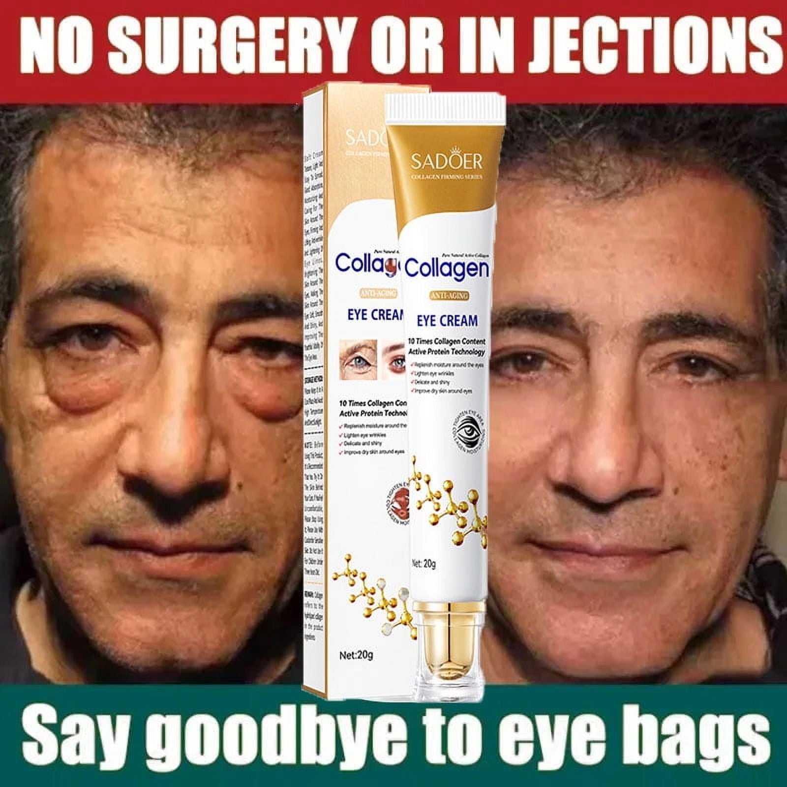 SADOER Collagen Instant Eye Bag Removal Cream 20g SADOER Collagen Instant Eye Bag Removal Cream 20g