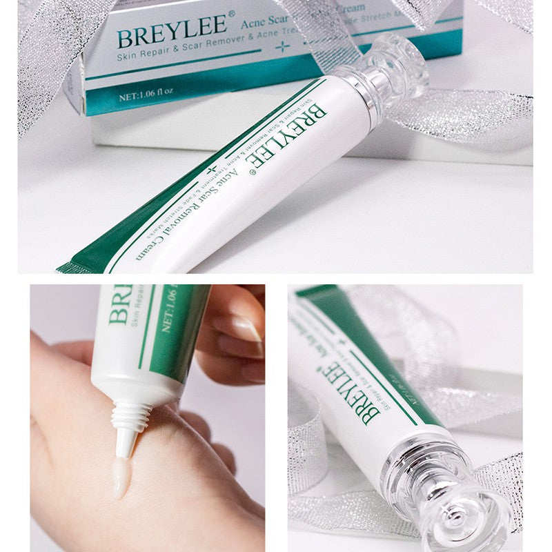 BREYLEE Acne Scar Removal Cream Skin Repair Skin Care Scar Acne Treatment Remove Stretch Marks Whitening Cream - Tuzzut.com Qatar Online Shopping