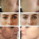 EELHOE Dark Spot Correcting Glow Serum 50ml - TUZZUT Qatar Online Shopping