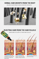 King Of Ginger 7 Days Ginger Germinal Oil Hair Tonic Growth Essence Anti-Fall Hair Treatment Care - Tuzzut.com Qatar Online Shopping