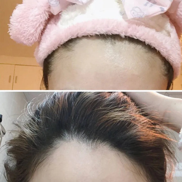 Hairline Repair Filling Powder With Hair Makeup Concealer Hairline Repair Filling Powder With Hair Makeup Concealer