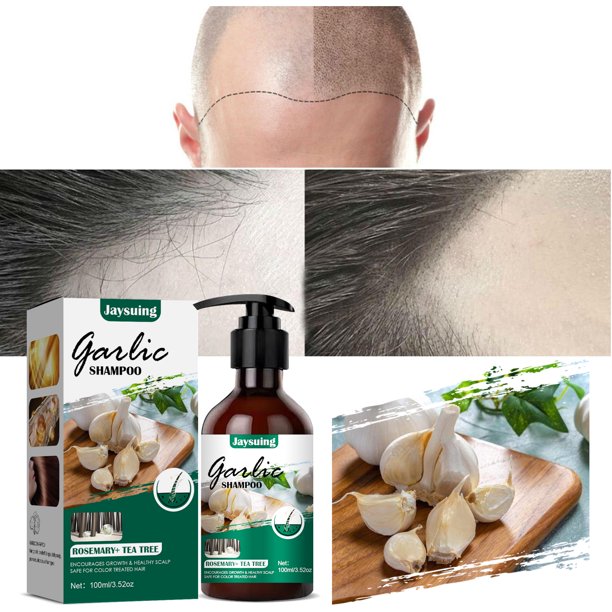 Garlic Shampoo Deep Cleansing Effective Hair Loss Treatment Garlic Shampoo Deep Cleansing Effective Hair Loss Treatment