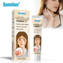 Vitiligo Removal Cream, Skin Vitiligo Treatment, Vitiligo Care Cream Reduces White Spots and Improves Skin Pigmentation (20g) B-389470 - TUZZUT Qatar Online Shopping