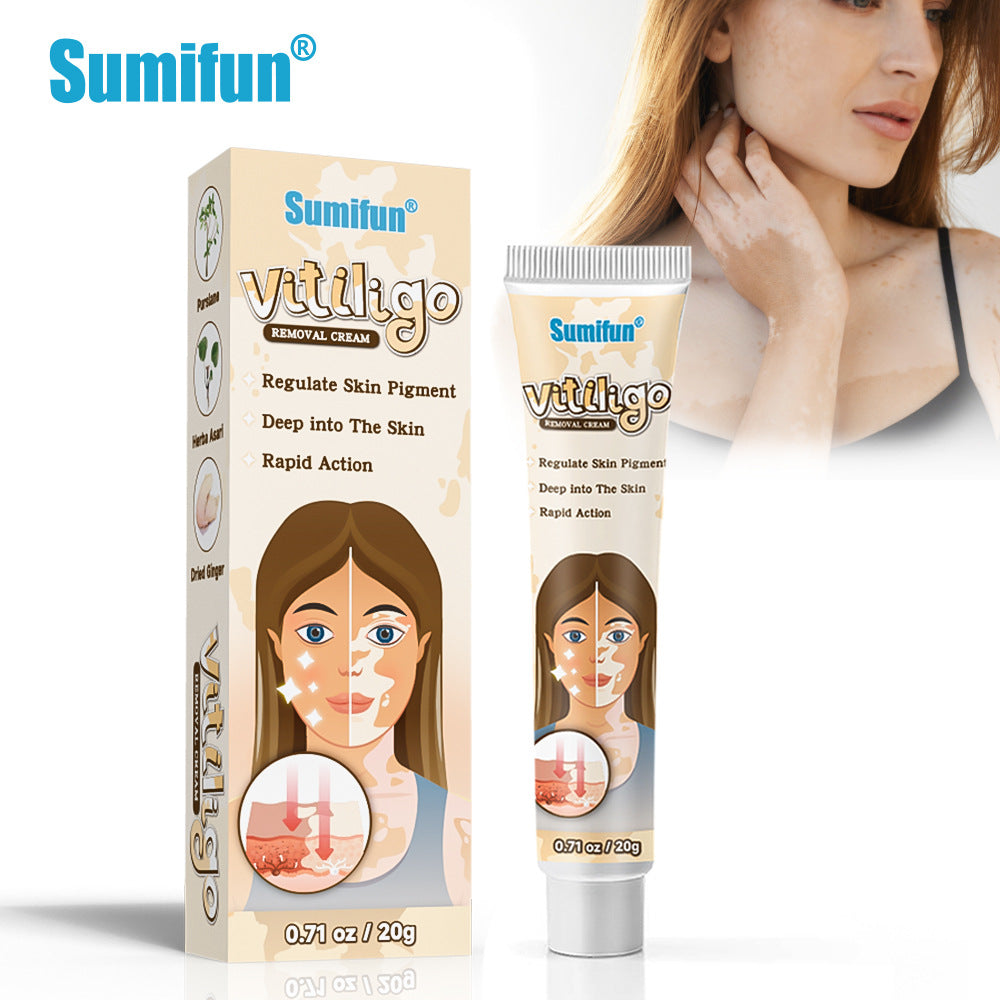 Vitiligo Removal Cream, Skin Vitiligo Treatment, Vitiligo Care Cream Reduces White Spots and Improves Skin Pigmentation (20g) B-389470 Vitiligo Removal Cream, Skin Vitiligo Treatment, Vitiligo Care Cream Reduces White Spots and Improves Skin Pigmentation (20g) B-389470