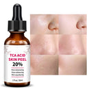 TCA Acid Skin Peel 20% Pore Minimizing Glow Enhancing Skin Resurfacing Serum