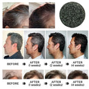 Sol lora Charcoal Hair Darkening Bar - Natural Shampoo Soap Bar for White to Black Hair - 60g (Pack of 3 Pcs) - TUZZUT Qatar Online Shopping