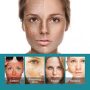 Eelhoe Dark Spots Removes Cream 20ml - TUZZUT Qatar Online Shopping