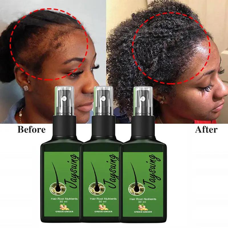 Natural Ginger Hair Growth Spray Jaysuing 120ml Natural Ginger Hair Growth Spray Jaysuing 120ml