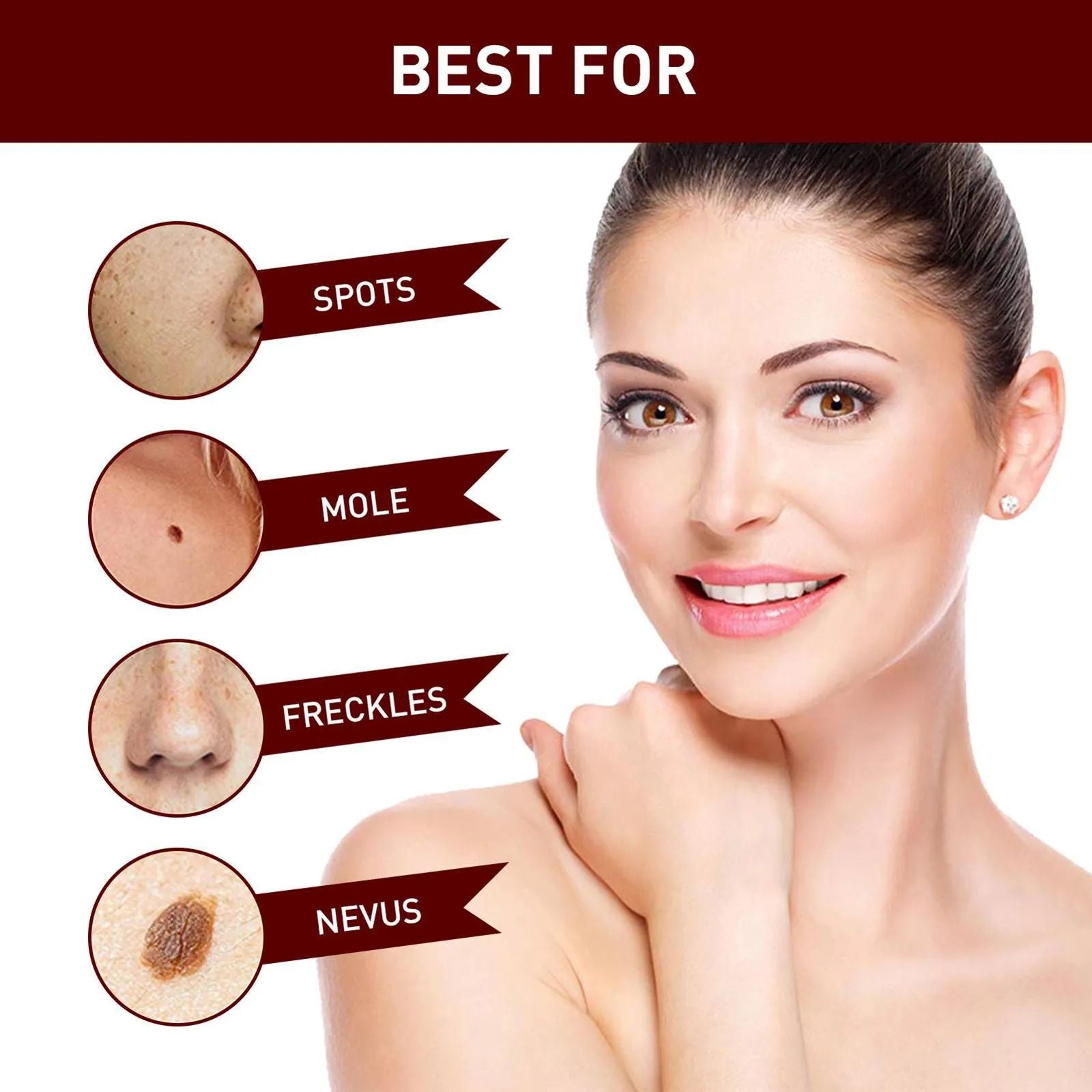 Wipe Off Tags and Mole Remover, Extreme Skin Tag Wipe Off Tags & Mole Remover 3ml Wipe Off Tags and Mole Remover, Extreme Skin Tag Wipe Off Tags & Mole Remover 3ml
