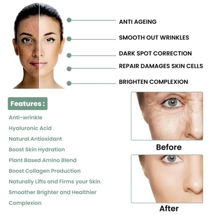 Eelhoe Advanced Collagen Boost Face Serum Lifting Firming Fade Fine Lines Wrinkle Anti-aging Facial Essence Brightening Skin Tone Whitening Moisturizing Face Nourishing Skin Care Booster Serum(30ml Eelhoe Advanced Collagen Boost Face Serum Lifting Firming Fade Fine Lines Wrinkle Anti-aging Facial Essence Brightening Skin Tone Whitening Moisturizing Face Nourishing Skin Care Booster Serum(30ml
