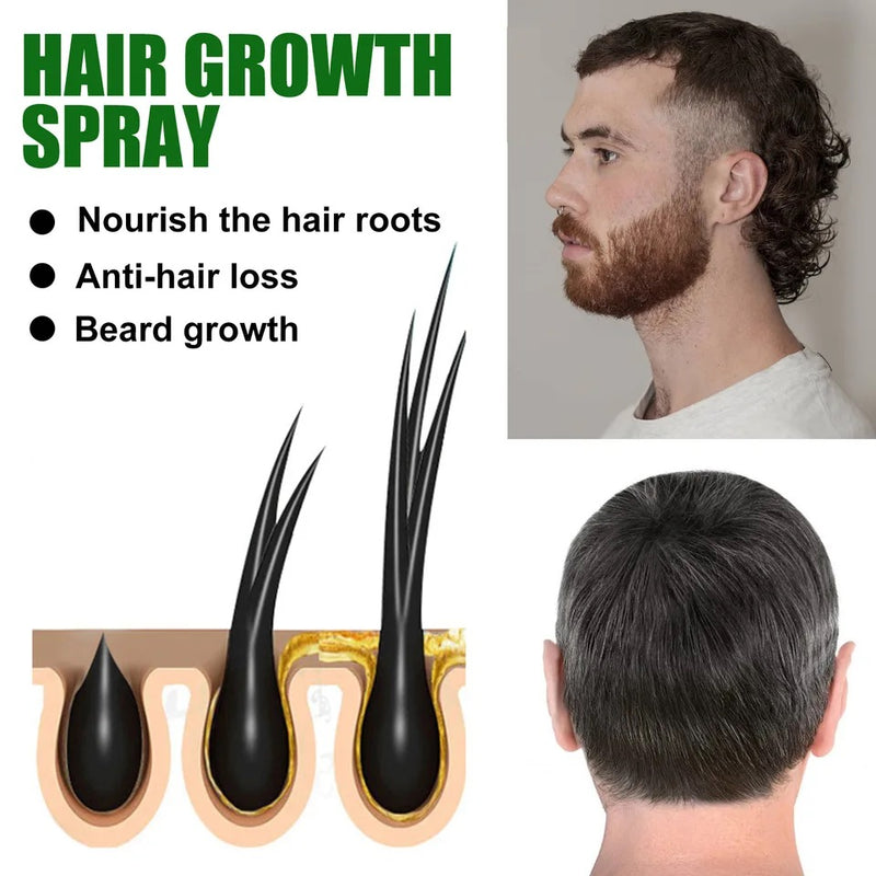 Caizilan - Hair Growth Spray- Prevents Hair loss - Hair growth Fluid- Organic - Tuzzut.com Qatar Online Shopping
