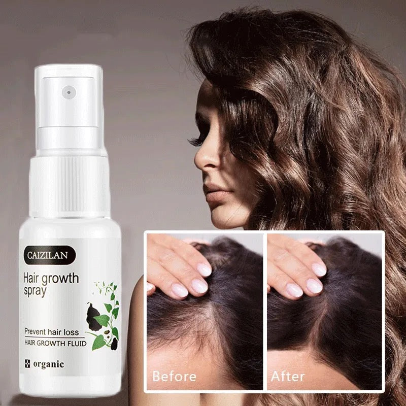 Caizilan - Hair Growth Spray- Prevents Hair loss - Hair growth Fluid- Organic