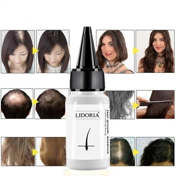 LIDORIA - Hair Growth Essence - Tuzzut.com Qatar Online Shopping