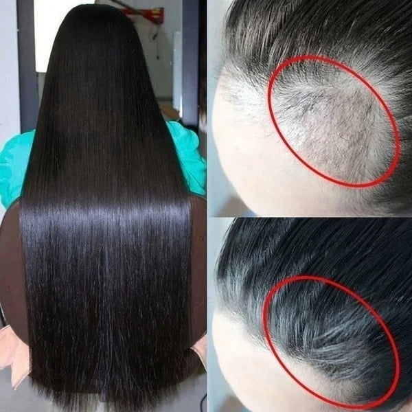 LIDORIA - Hair Growth Essence - Tuzzut.com Qatar Online Shopping