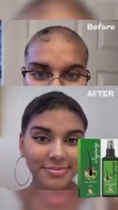 Natural Ginger Hair Growth Spray Jaysuing 120ml