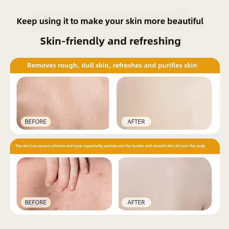 Sulfur Liquid Soap Mites Removal Bath Gel Deep Cleaning Shower Gel 300ml - TUZZUT Qatar Online Shopping