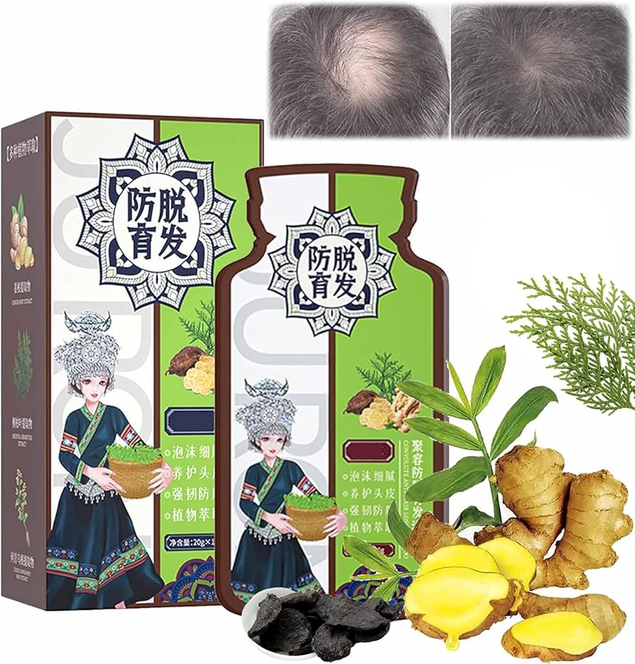 Ginger Plant Extract Convolute Anti-Hair Loss Shampoo Ginger Plant Extract Convolute Anti-Hair Loss Shampoo