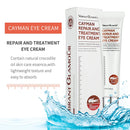 VIBRANT GLAMOUR Magic Anti-age Eye Cream Cayman Eye Cream Eye Serum Wrinkle S4720855 - Tuzzut.com Qatar Online Shopping