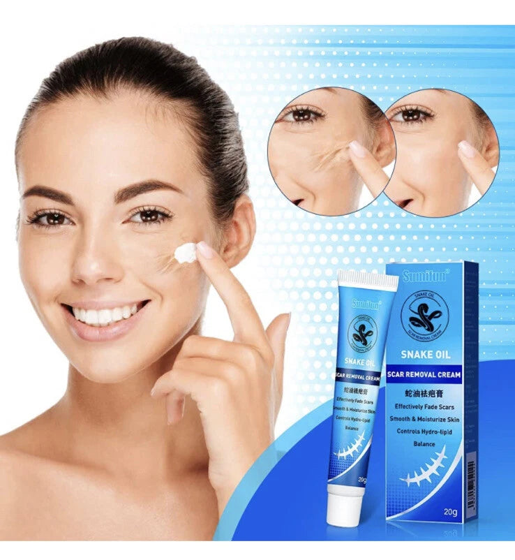 Sumifun Scar Repair Cream 20g - TUZZUT Qatar Online Shopping