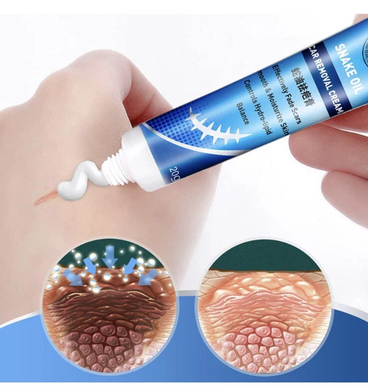 Sumifun Scar Repair Cream 20g Sumifun Scar Repair Cream 20g