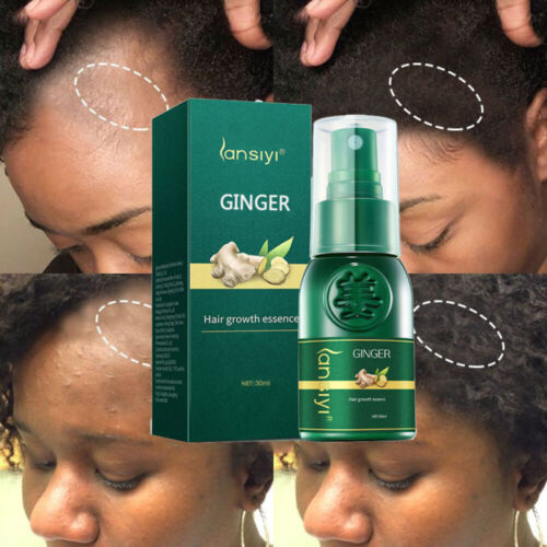 Hair Growth Serum Spray Dense Fast Regrowth Ginger Oil Hair Loss Treatment Care - Tuzzut.com Qatar Online Shopping