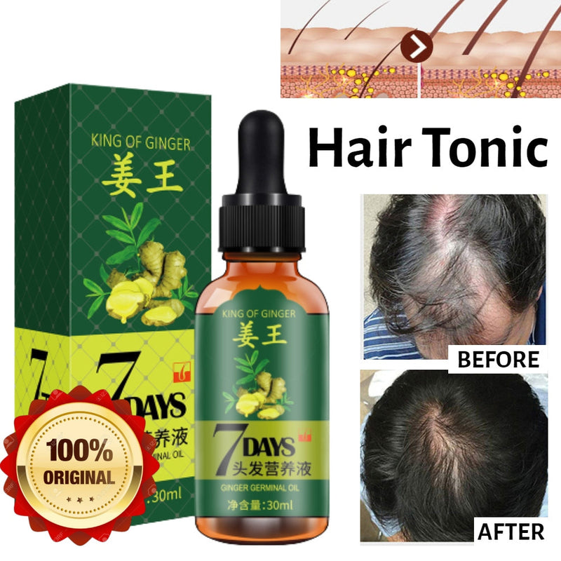 King Of Ginger 7 Days Ginger Germinal Oil Hair Tonic Growth Essence Anti-Fall Hair Treatment Care - Tuzzut.com Qatar Online Shopping