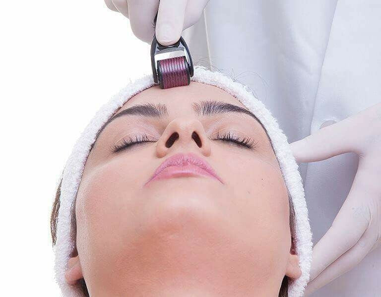 Derma Roller with 540 Stainless Alloy Needles Derma Roller with 540 Stainless Alloy Needles