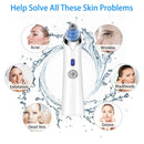 Rechargeable Vacuum Suction Blackhead Remover Facial Comedo Acne Pimple Extractor Tool Diamond Dermabrasion Face Peeling Beauty Care - Tuzzut.com Qatar Online Shopping