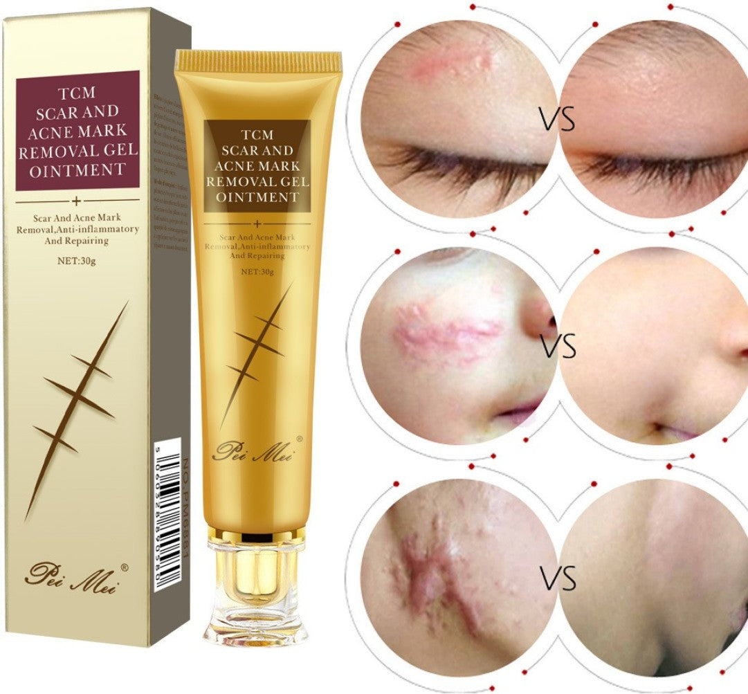 PEI MEI TCM Scar Removal Cream Acne Treatment Acne Control Acne Scar Removal PEI MEI TCM Scar Removal Cream Acne Treatment Acne Control Acne Scar Removal