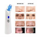 Rechargeable Vacuum Suction Blackhead Remover Facial Comedo Acne Pimple Extractor Tool Diamond Dermabrasion Face Peeling Beauty Care - Tuzzut.com Qatar Online Shopping
