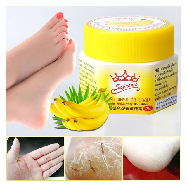 Banana Foot Care Balm Crack Relief Whitening Smooth Skin Creams Skin Cream Moisturizing Heel Prevent Dry Crack Ointment