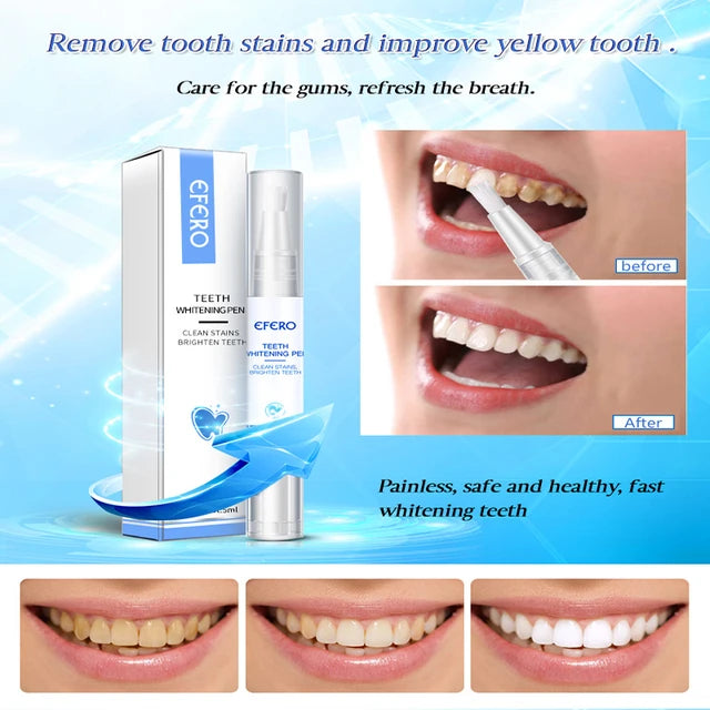 Teeth Whitening Essence Removes Plaque Stain Tooth Bleaching Cleaning Serum White Teeth Oral Hygiene Tooth Whitening Pen - Tuzzut.com Qatar Online Shopping